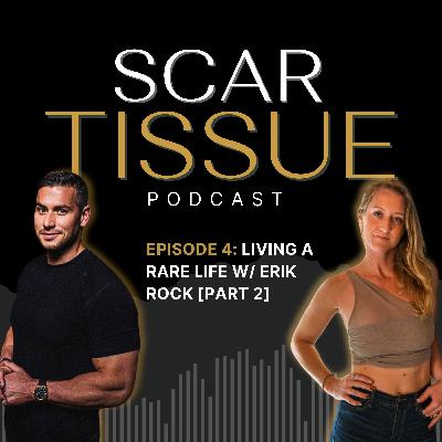 Living a Rare Life with Erik Rock [Part 2]