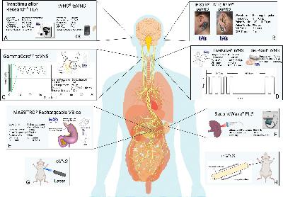 Interorgan Insights: Vagus nerve stimulation across disease states