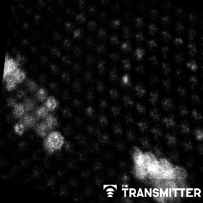 Waves of calcium activity dictate eye structure in flies Waves of calcium activity dictate eye structure in flies