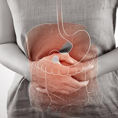 Dr. Rachid Jorio: Syndrome du Côlon irritable (SCI) Dr. Rachid Jorio: Syndrome du Côlon irritable (SCI)