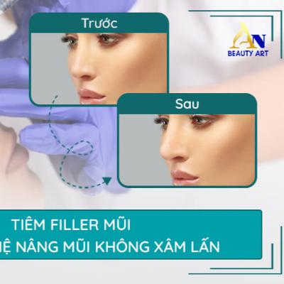 Tiêm Filler Mũi Có Tác Dụng Gì? Giữ Được Bao Lâu? Giá Bao Nhiêu?