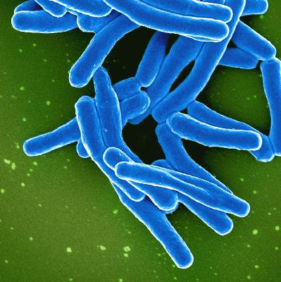 ID4U Episode 3 Tuberculosis Part 2
