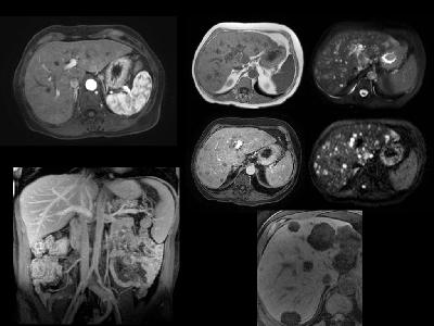 Episode 12: Body MRI