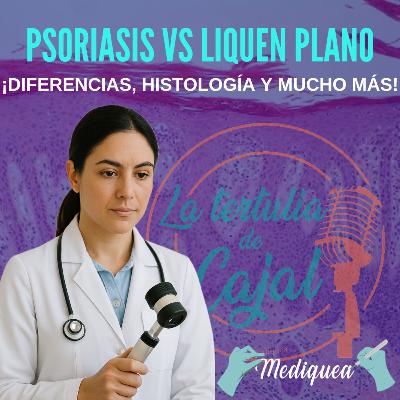 #45 Psoriasis vs Liquen plano - Podcast MIR