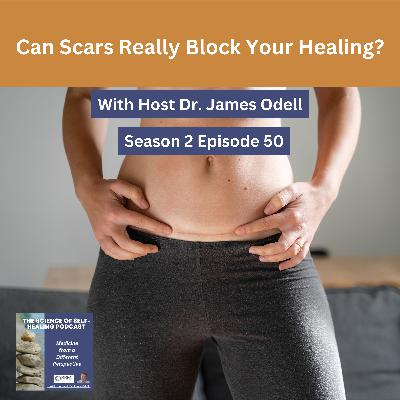 Can Scars Really Block Your Healing?