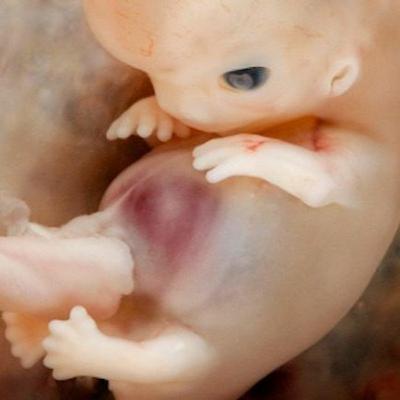 Episode 14: Pro-Life Activism in a Pandemic Episode 14: Pro-Life Activism in a Pandemic