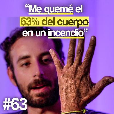 Llevo piel de laboratorio tras el incendio - Álvaro Trigo | Un Propósito #63