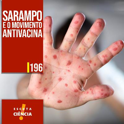 Sarampo e Movimento Antivacina
