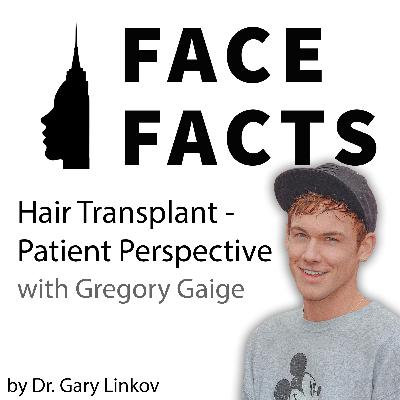 Hair Transplant - Patient Perspective with Gregory Gaige - Dr. Gary Linkov Hair Transplant - Patient Perspective with Gregory Gaige - Dr. Gary Linkov