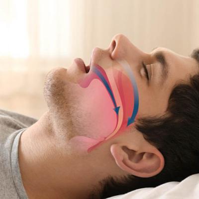 Você ronca? Pode ser apneia do sono Você ronca? Pode ser apneia do sono