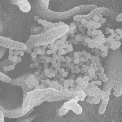 Épisode 7 : Comploronavirus