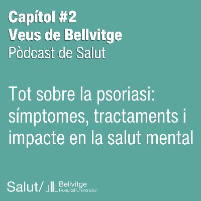Tot sobre la psoriasi: símptomes, tractaments i salut mental
