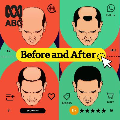 01 Before and After | The cost of keeping your hair