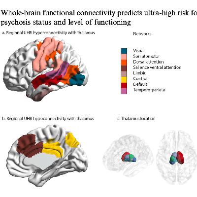 602-Whole-Brain Connectivity Predicts Psychosis Risk