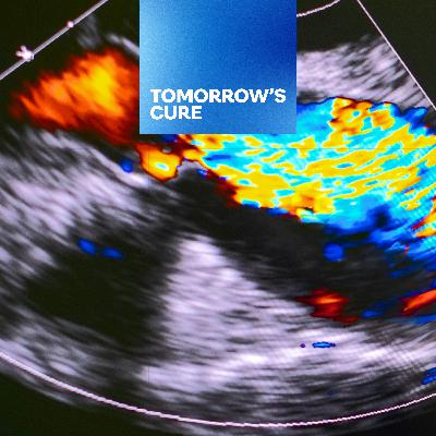 AI Enhanced Handheld Ultrasound Improves Heart Care