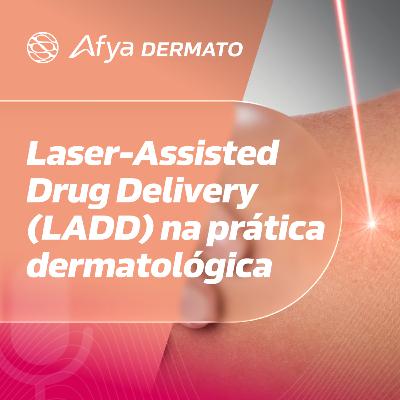 Laser-Assisted Drug Delivery (LADD) na prática dermatológica