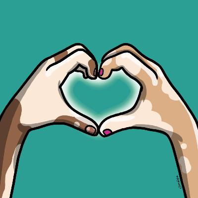 VITI VIDA (VITILIGO)- Primera parte VITI VIDA (VITILIGO)- Primera parte