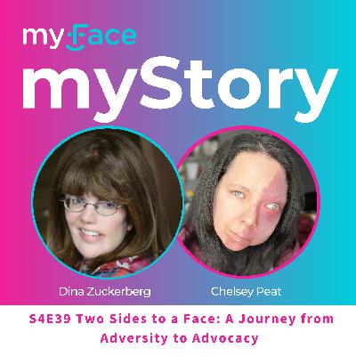 Two Sides to a Face: A Journey from Adversity to Advocacy