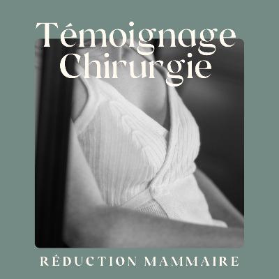 J’aurais dû le faire avant : ma réduction mammaire J’aurais dû le faire avant : ma réduction mammaire