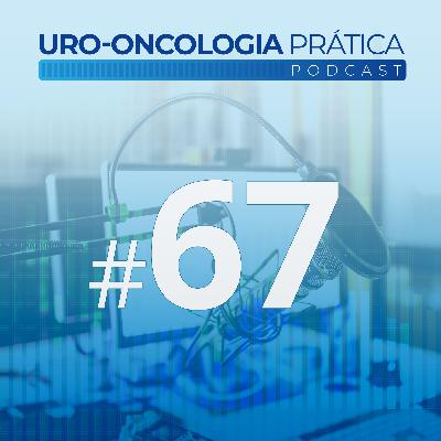 Uro-Oncologia Prática 67 - Papel da radioterapia para tratamento do tumor primário de próstata: discussão do Peace-1