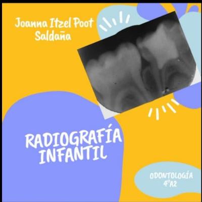 Radiografía Infantil