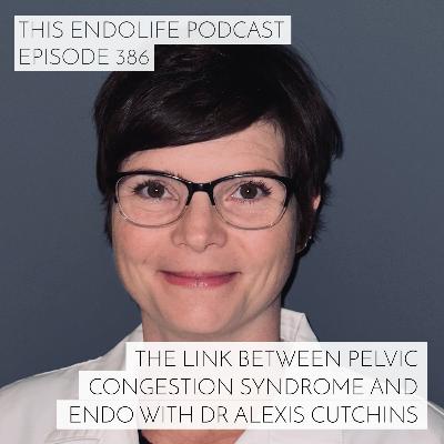 The Link Between Pelvic Congestion Syndrome and Endometriosis with Dr Alexis Cutchins The Link Between Pelvic Congestion Syndrome and Endometriosis with Dr Alexis Cutchins