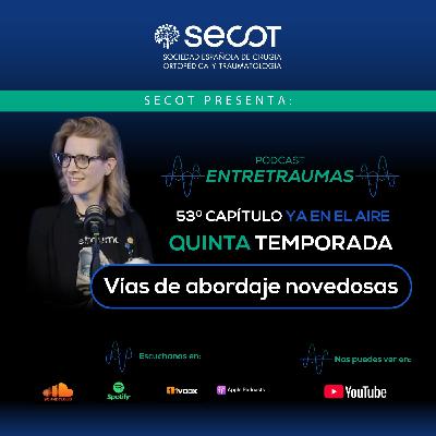Vías de abordaje