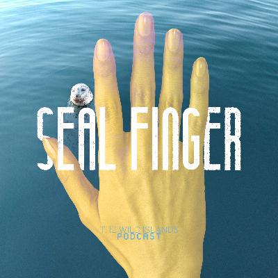 Seal Finger | Episode Two