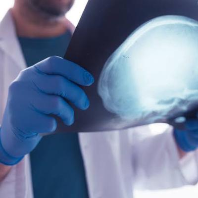 Perícias necroscópicas na identificação humana com imagens radiográficas