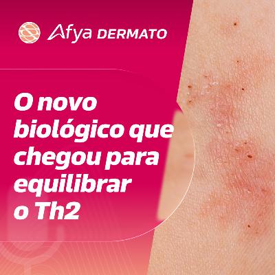 Lebrikizumab: bloqueando a IL-13 e redefinindo a resposta clínica