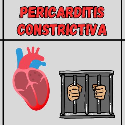 Capítulo 165: Pericarditis constrictiva