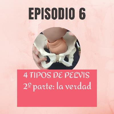 ¿¿4 tipos de pelvis?? - 2º parte: La verdad (+PDF descarga) ¿¿4 tipos de pelvis?? - 2º parte: La verdad (+PDF descarga)