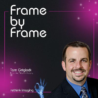 Why Medical Physicists Are Drowning in Level 1 Tasks (And What It Means for AI Adoption)