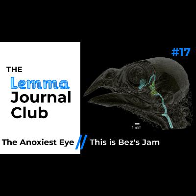 The Anoxiest Eye // This is Bez's Jam [17]