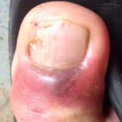 #1 Episode of Big TOE podcast with ZONE TIME and the Nephew