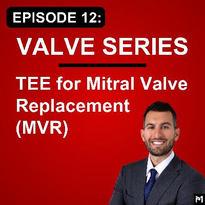 12. TEE for Mitral Valve Replacement (MVR) Surgery