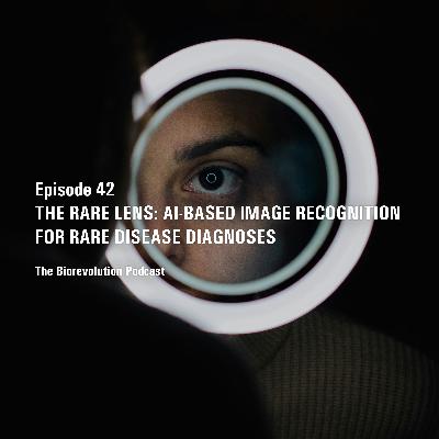 The Rare Lens: AI-based image recognition for rare disease diagnoses The Rare Lens: AI-based image recognition for rare disease diagnoses