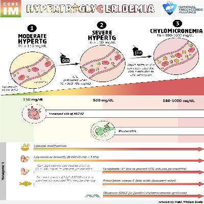#194: Severe Hypertriglyceridemia: 5 Pearls Segment #194: Severe Hypertriglyceridemia: 5 Pearls Segment