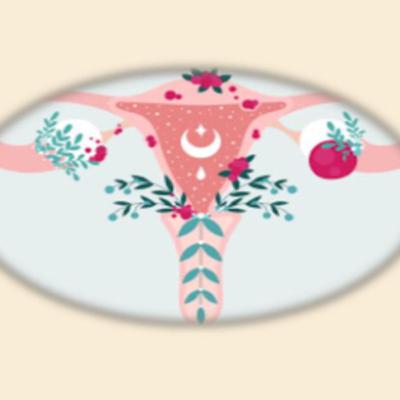 Síndrome de ovario poliquístico SOP Síndrome de ovario poliquístico SOP