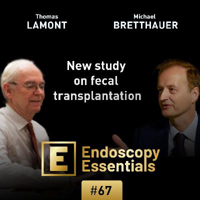 New study on fecal transplantation in primary clostridium difficile infection