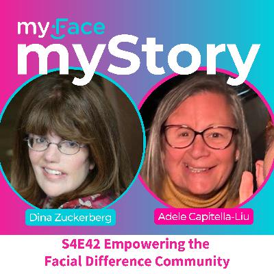 Empowering the Facial Difference Community with Special Guest Adele Capitella-Liu