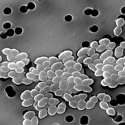 Re-thinking the theory of autoimmunity in the era of the microbiome Re-thinking the theory of autoimmunity in the era of the microbiome