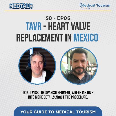TAVR - Heart valve replacement in Mexico