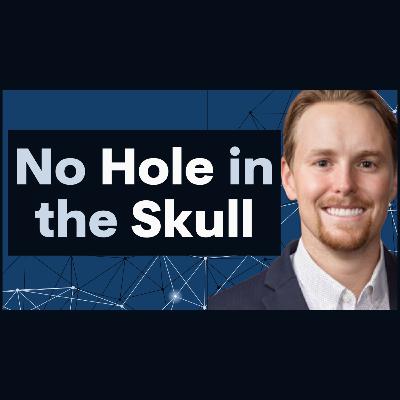 Brain implants without a hole in your skull - Wes Jones of Vonova Brain implants without a hole in your skull - Wes Jones of Vonova