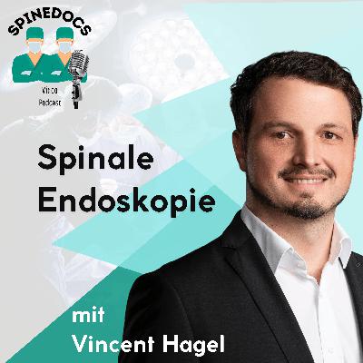 Spinale Endoskopie