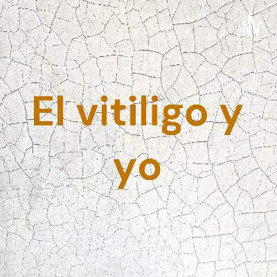 El vitiligo y yo