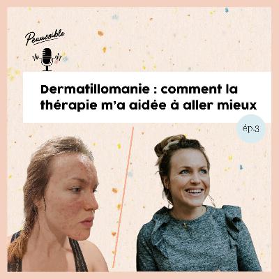 3. Comment la thérapie m'a aidée à aller mieux (dermatillomanie, anxiété) 3. Comment la thérapie m'a aidée à aller mieux (dermatillomanie, anxiété)