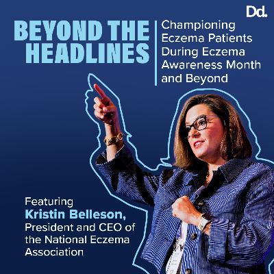 Beyond the Headlines: Championing Eczema Patients During Eczema Awareness Month and Beyond Beyond the Headlines: Championing Eczema Patients During Eczema Awareness Month and Beyond
