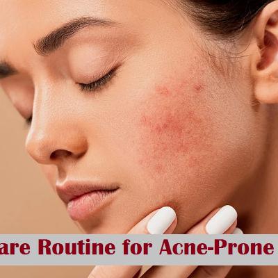 Best 6 Steps of Skincare Routine for Acne Prone Skin
