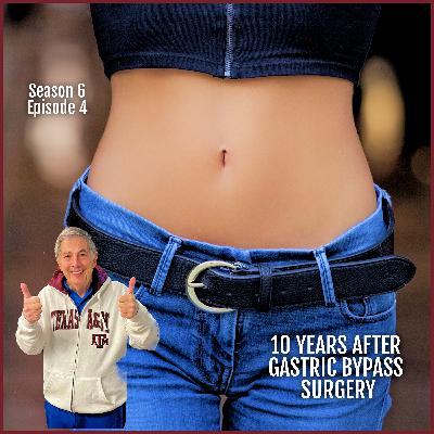 S6 E4 Gastric ByPass Surgery Before and After - A True Story